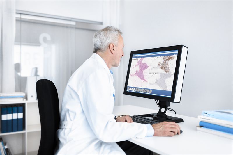 Effektivare och snabbare cancerdiagnoser – Sectra och Software Point integrerar sina IT-system för digital patologi och LIMS