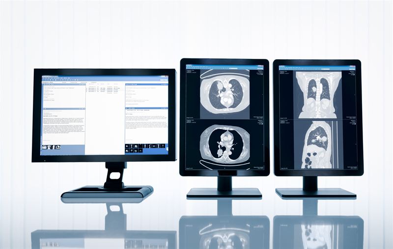 Sjukhus i London investerar i Sectras IT‑tjänst för hantering av medicinska bilder