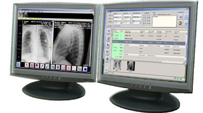 Amerikansk sjukhusgrupp beställer Sectras IT-lösning för att granska medicinska bilder