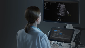 Samsung Medison använder AI för snabbare och mer exakta ultraljud vid graviditeter 2