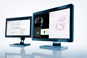 Amsterdam UMC utökar medicinsk IT-lösning från Sectra med digital patologi – möjliggör integrerad diagnostik för bättre cancervård