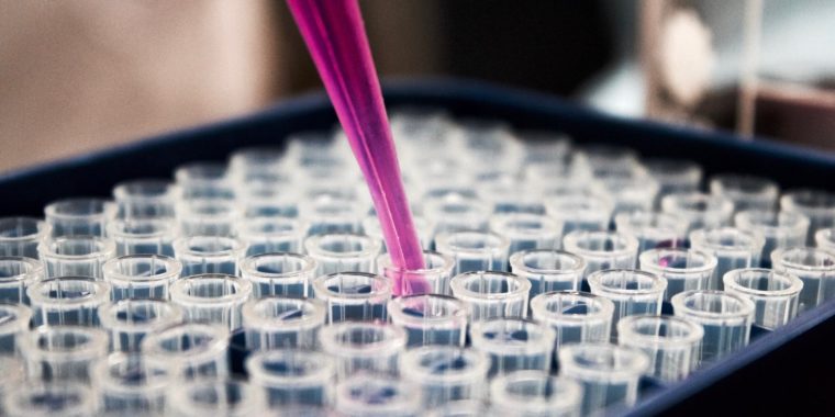 SAGA Diagnostics accelererar kommersialiseringen av ultrakänsliga liquid biopsy metoder för detektion av cancer