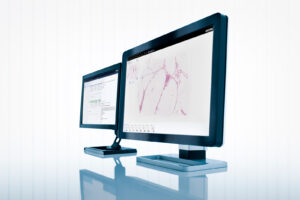 Universitetssjukhus i Nederländerna väljer Sectras digitala patologilösning för fullskalig primärdiagnostik
