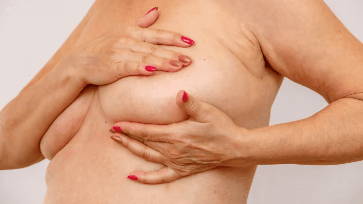 Blodprov kan visa risk för spridd bröstcancer