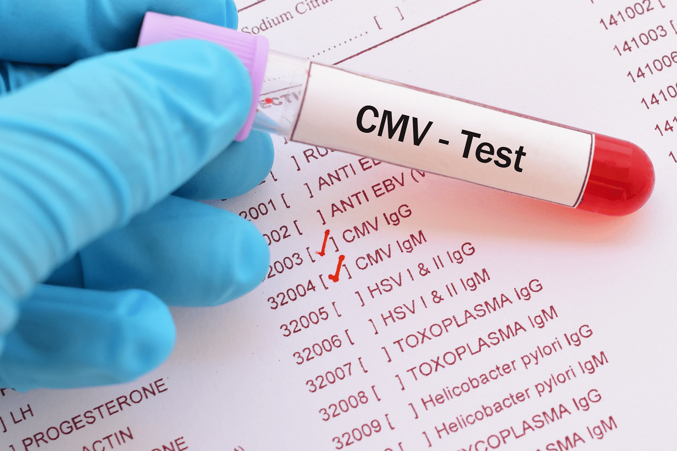 Sjukvården måste informera föräldrar om CMV-viruset
