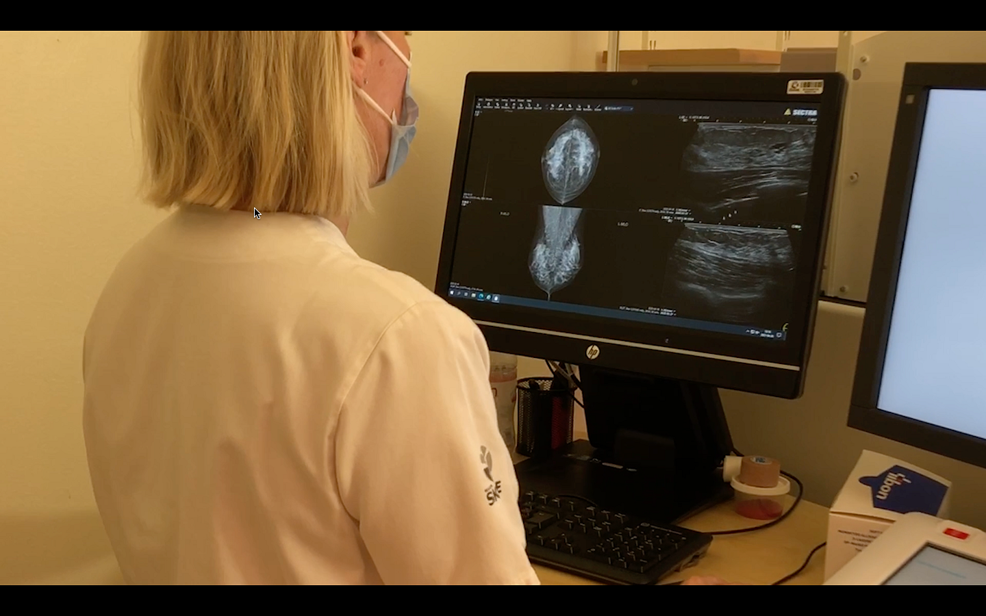Kvinnor välkomnar ny teknik i bröstcancervården – AI-teknik kan revolutionera mammografin