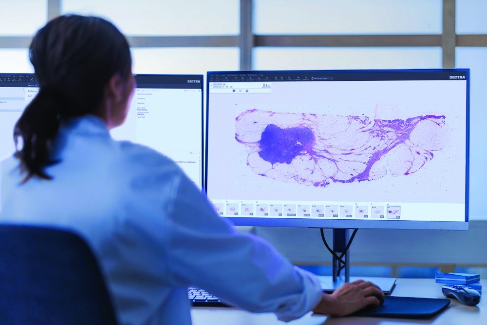 Israels vårdgivare väljer Sectras för digitala patologilösningen