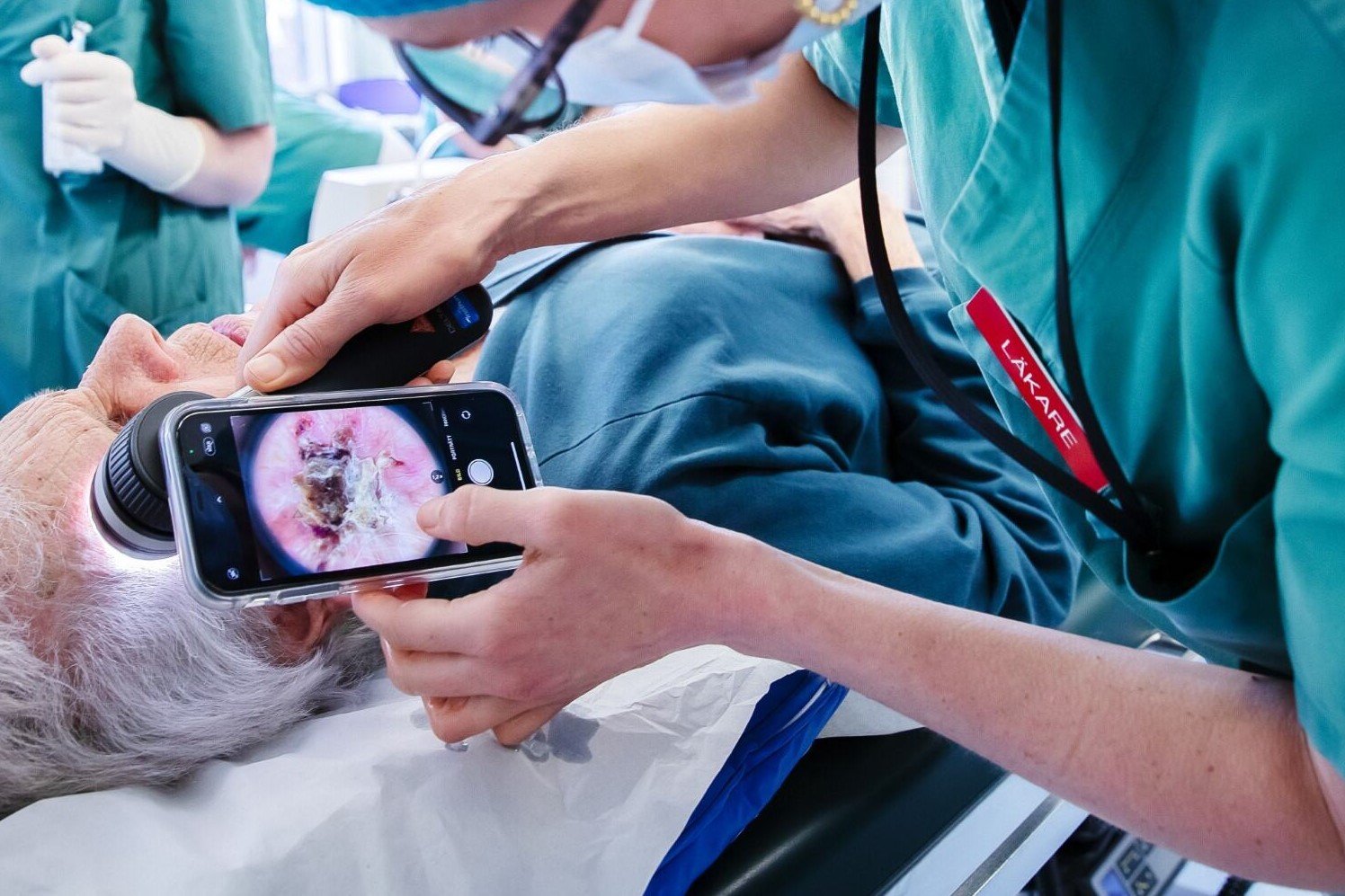 Digitalt stöd kan hitta allvarlig hudcancer
