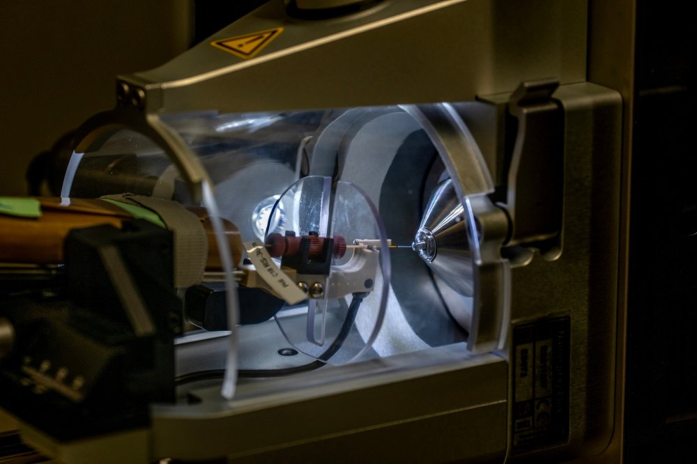 AI underlättar sockertest för cancer