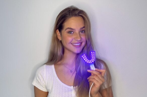 Pågående studie utforskar effekten av fotodynamisk terapi hos ungdomar som genomgår ortodontisk behandling