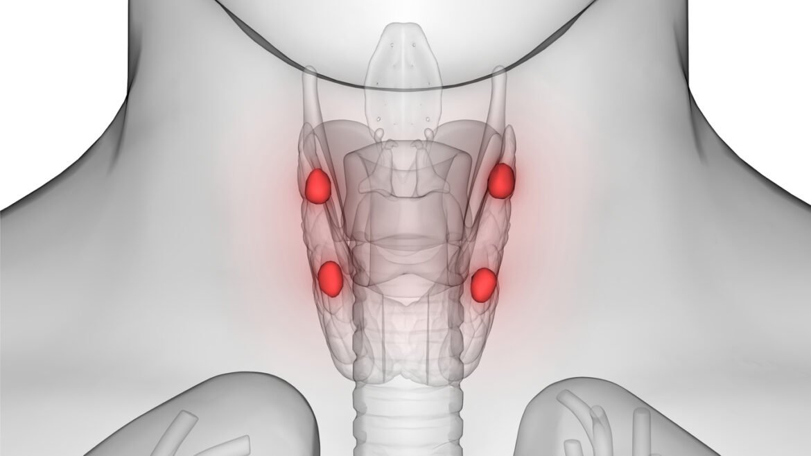 Patienter med hypoparatyreoidism behöver hormonersättning