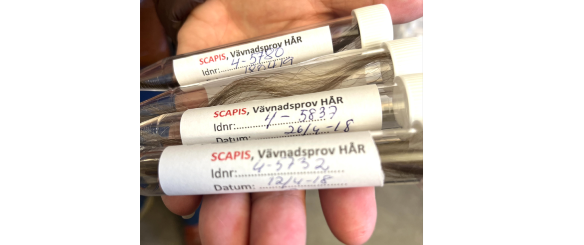 Ny forskning från Hjärt-Lungfondens forskningssatsning SCAPIS visar: Stresshormon i hårstrån kan varna för hjärtinfarkt