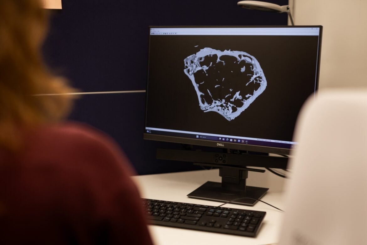 Forskning om östrogenets potential att förebygga benskörhet