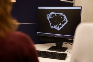 Forskning om östrogenets potential att förebygga benskörhet