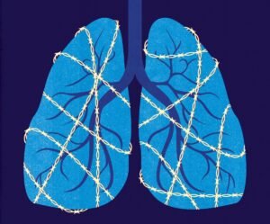 KOL nästan fördubblar risken för hjärtinfarkt