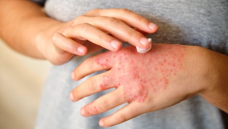 TIRmed Pharma tar in 48 MSEK