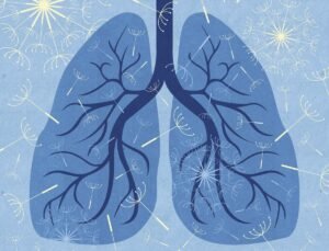 Många med astma tar inte sina läkemedel