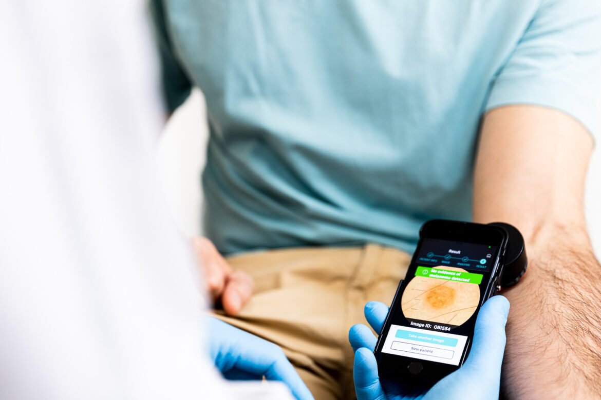 Dermalyser CE-märkt i Europa