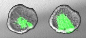 Odlade organ avslöjar de aggressiva bakteriernas vapen