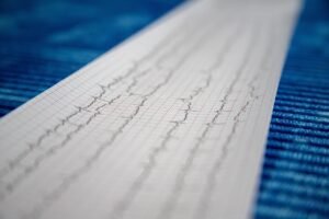 Världshjärtdagen: Sverige halkar efter i diagnos av ärftlig hjärtsjukdom