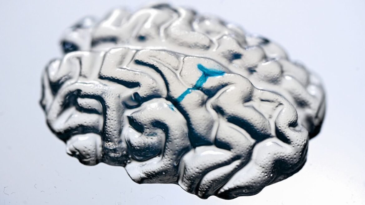 Stora donationer till nydanande behandling mot parkinsons