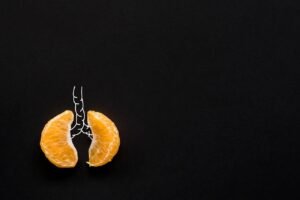 PExA:s forskningsinstrument för diagnos av lungcancer uppmärksammas