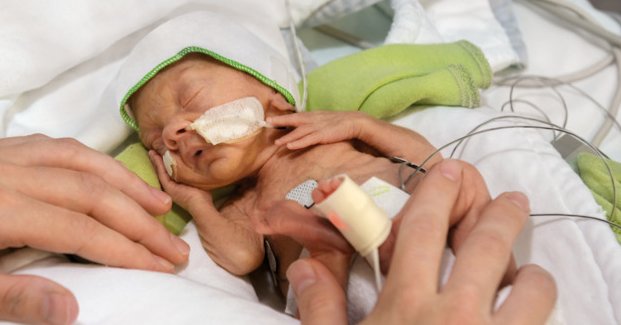 Getinge stöttar utbildning inom neonatal intensivvård i Indien